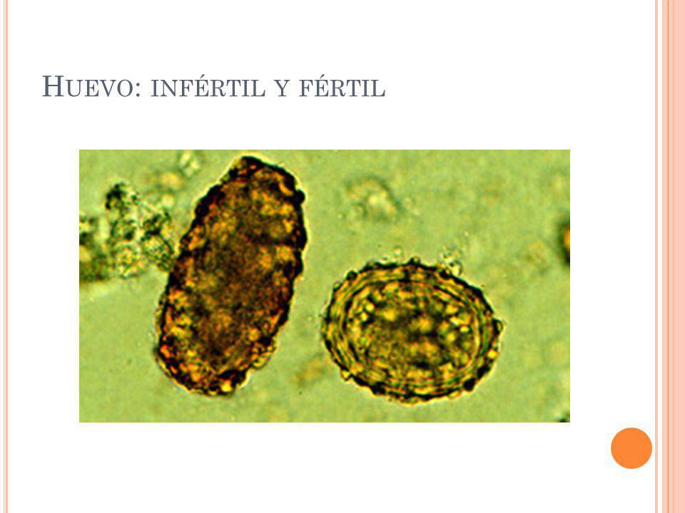 huevos de ascaris lumbricoides en niños